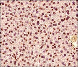 Invitrogen MECP2 Polyclonal Antibody 100 &mu;g; Unconjugated:Antibodies,