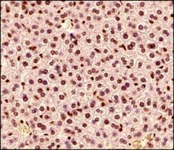 Invitrogen MECP2 Polyclonal Antibody 100 &mu;g; Unconjugated:Antibodies,