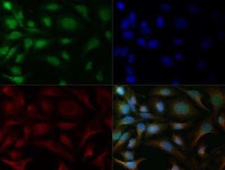 Invitrogen NOXA Polyclonal Antibody 100 &mu;g; Unconjugated:Antibodies,