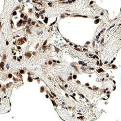 Invitrogen SMAD6 Polyclonal Antibody 100 &mu;g; Unconjugated:Antibodies,