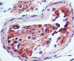 Invitrogen HTR3A Polyclonal Antibody 100 &mu;g | Buy Online | Invitrogen&trade; | Fisher Scientific