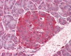 Invitrogen NOD1 Polyclonal Antibody 100 &mu;L; Unconjugated:Antibodies,