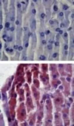 Invitrogen TLR2 Polyclonal Antibody 100 &mu;g | Buy Online | Invitrogen&trade; | Fisher Scientific