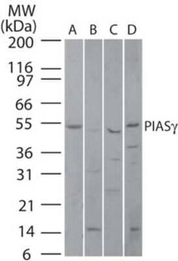 Invitrogen PIASy Polyclonal Antibody 100 &mu;g | Buy Online | Invitrogen&trade; | Fisher Scientific