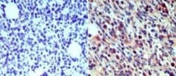 Invitrogen Langerin Polyclonal Antibody 100 &mu;g; Unconjugated:Antibodies,