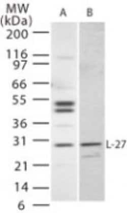 Invitrogen IL-27 p28 Polyclonal Antibody 100 &mu;g; Unconjugated:Antibodies,