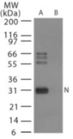 Invitrogen Influenza A H6N1 NP Polyclonal Antibody 100 &mu;g; Unconjugated:Antibodies,