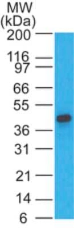 Invitrogen CCR1 Polyclonal Antibody 100 &mu;g | Buy Online | Invitrogen&trade; | Fisher Scientific