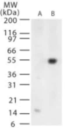 Invitrogen West Nile Virus Envelope Polyclonal Antibody 100 &mu;g; Unconjugated:Antibodies,