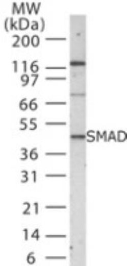Invitrogen SMAD1/SMAD5/SMAD9 Polyclonal Antibody 100 &mu;g; Unconjugated:Antibodies,