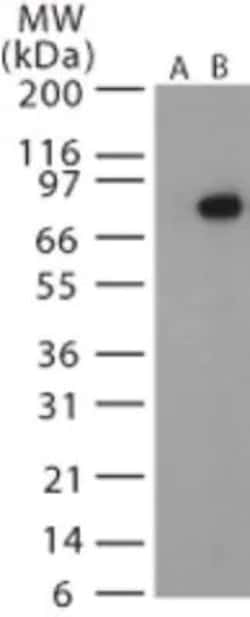 Invitrogen Anthrax Protective Antigen Polyclonal Antibody 200 &mu;L; Unconjugated:Antibodies,