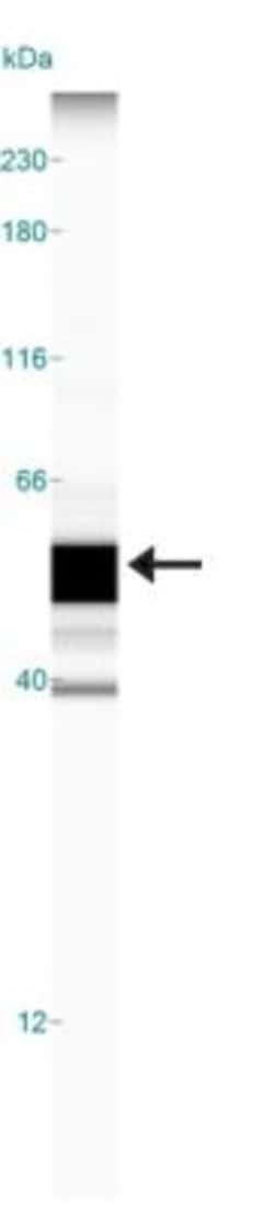 Invitrogen CCR10 Polyclonal Antibody 100 &mu;g; Unconjugated:Antibodies,