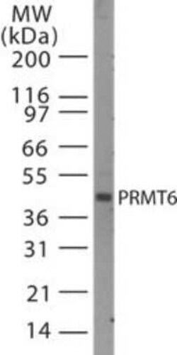 Invitrogen PRMT6 Polyclonal Antibody 200 &mu;L | Buy Online | Invitrogen&trade; | Fisher Scientific