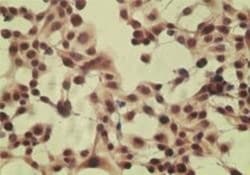 Invitrogen CYLD Polyclonal Antibody 100 &mu;g; Unconjugated:Antibodies,