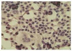 Invitrogen CYLD Polyclonal Antibody 100 &mu;g; Unconjugated:Antibodies,