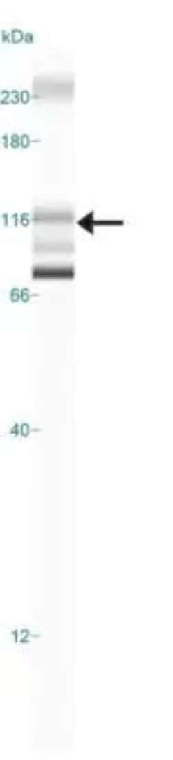 Invitrogen CYLD Polyclonal Antibody 100 &mu;g; Unconjugated:Antibodies,