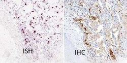 Invitrogen SARS Coronavirus Nucleocapsid Polyclonal Antibody 100 &mu;g | Buy Online | Invitrogen&trade; | Fisher Scientific