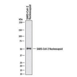 Invitrogen SARS Coronavirus Nucleocapsid Polyclonal Antibody 100 &mu;g;