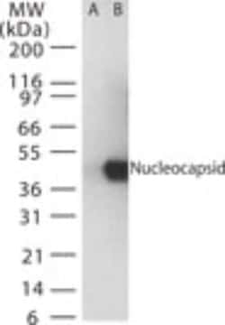 Invitrogen SARS Coronavirus Nucleocapsid Polyclonal Antibody 100 &mu;g | Buy Online | Invitrogen&trade; | Fisher Scientific
