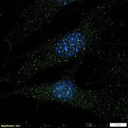 Invitrogen TAK1 Polyclonal Antibody 100 &mu;g | Buy Online | Invitrogen&trade; | Fisher Scientific