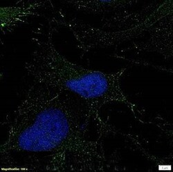 Invitrogen TAK1 Polyclonal Antibody 100 &mu;g | Buy Online | Invitrogen&trade; | Fisher Scientific
