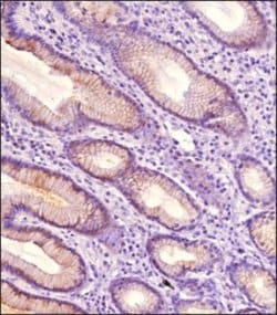 Invitrogen TAK1 Polyclonal Antibody 100 &mu;g; Unconjugated:Antibodies,