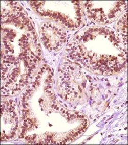 Invitrogen PRMT4 Polyclonal Antibody 100 &mu;g; Unconjugated:Antibodies,