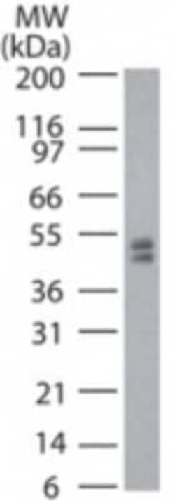 Invitrogen Dnmt2 Polyclonal Antibody 100 &mu;g | Buy Online | Invitrogen&trade; | Fisher Scientific