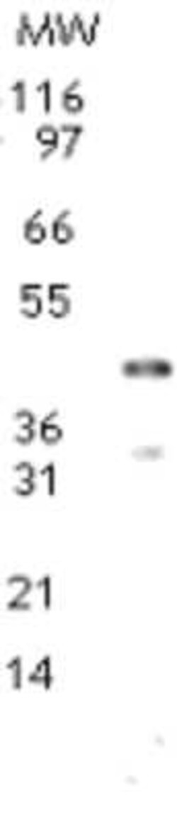 Invitrogen Dnmt2 Polyclonal Antibody 100 &mu;g | Buy Online | Invitrogen&trade; | Fisher Scientific