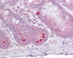 Invitrogen SETD7 Polyclonal Antibody 200 &mu;L; Unconjugated:Antibodies,
