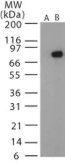 Invitrogen Anthrax Protective Antigen Polyclonal Antibody 200 &mu;L; Unconjugated:Antibodies,