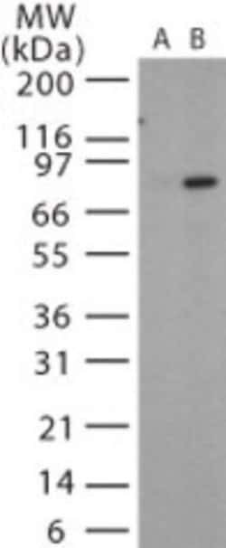 Invitrogen Anthrax Protective Antigen Polyclonal Antibody 200 &mu;L; Unconjugated:Antibodies,
