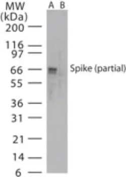 Invitrogen SARS Coronavirus Spike Protein Polyclonal Antibody 100 &mu;g;