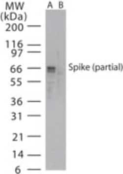Invitrogen SARS Coronavirus Spike Protein Polyclonal Antibody 100 &mu;g | Buy Online | Invitrogen&trade; | Fisher Scientific