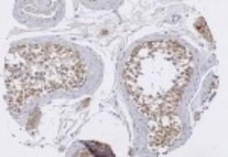 Invitrogen TRIM29 Polyclonal Antibody 100 &mu;g | Buy Online | Invitrogen&trade; | Fisher Scientific