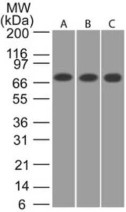 Invitrogen CaMKII beta Polyclonal Antibody 100 &mu;L | Buy Online | Invitrogen&trade; | Fisher Scientific