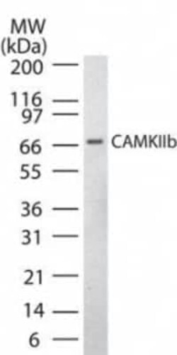 Invitrogen CaMKII beta Polyclonal Antibody 100 &mu;L | Buy Online | Invitrogen&trade; | Fisher Scientific