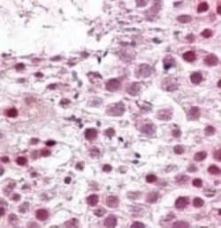 Invitrogen SUMO2/SUMO3 Polyclonal Antibody 100 &mu;g; Unconjugated:Antibodies,