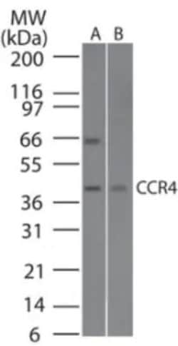 Invitrogen CCR4 Polyclonal Antibody 100 &mu;g; Unconjugated:Antibodies,