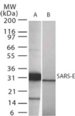 Invitrogen SARS Envelope Protein Polyclonal Antibody 100 &mu;g; Unconjugated:Antikörper