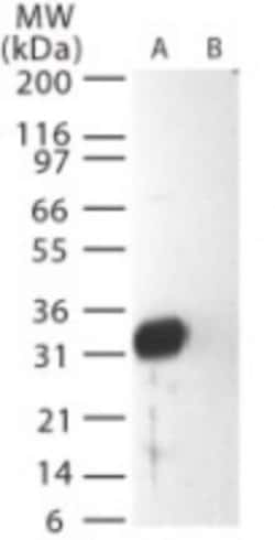 Invitrogen SARS Coronavirus Matrix Polyclonal Antibody 100 &mu;g; Unconjugated:Antibodies,