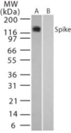 Invitrogen&trade;&nbsp;SARS Coronavirus Spike Protein Polyclonal Antibody