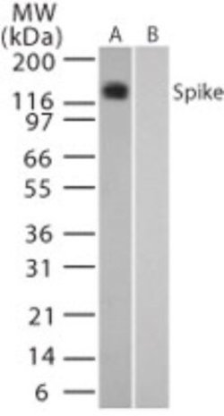 Invitrogen SARS Coronavirus Spike Protein Polyclonal Antibody 100 &mu;g;