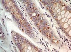 Invitrogen AGR2 Polyclonal Antibody 100 &mu;g | Buy Online | Invitrogen&trade; | Fisher Scientific
