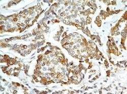Invitrogen AGR2 Polyclonal Antibody 100 &mu;g | Buy Online | Invitrogen&trade; | Fisher Scientific