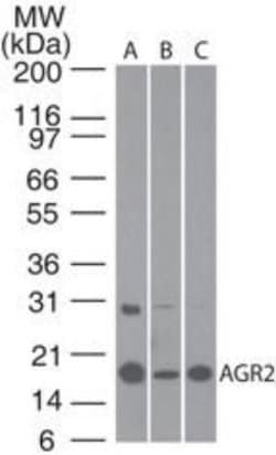Invitrogen AGR2 Polyclonal Antibody 100 &mu;g | Buy Online | Invitrogen&trade; | Fisher Scientific