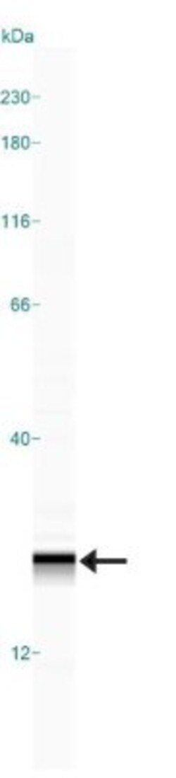 Invitrogen AGR2 Polyclonal Antibody 100 &mu;g | Buy Online | Invitrogen&trade; | Fisher Scientific