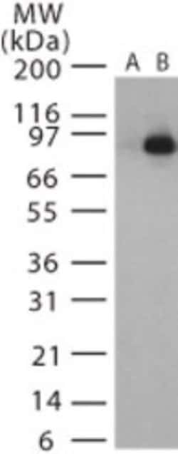 Invitrogen Anthrax Lethal Factor Polyclonal Antibody 200 &mu;L; Unconjugated:Antibodies,