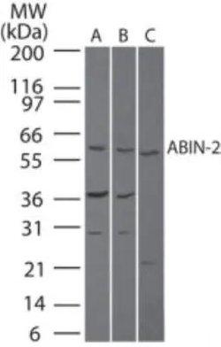 TNIP2 Polyclonal Antibody:Antibodies, Polyclonal