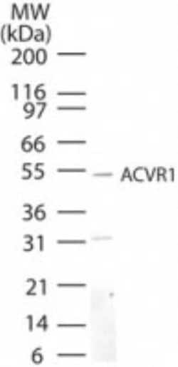 Invitrogen ACVR1 Polyclonal Antibody 100 &mu;g; Unconjugated:Antibodies,